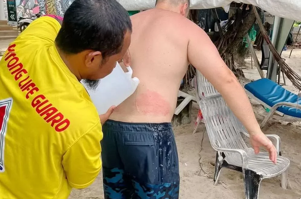 Turyści poparzeni przez meduzy na Patong Beach. Ratownicy ostrzegają